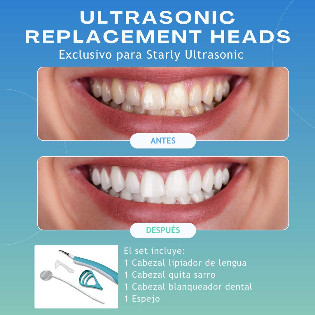 Limpiador Dental con Vibración de Alta Frecuencia para Limpieza Profunda y Efectiva